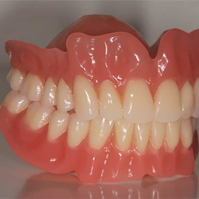 Full acrylic denture 1 Full Acrylic denture 1