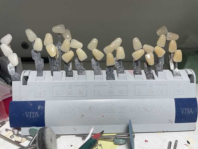 VITA tooth guide