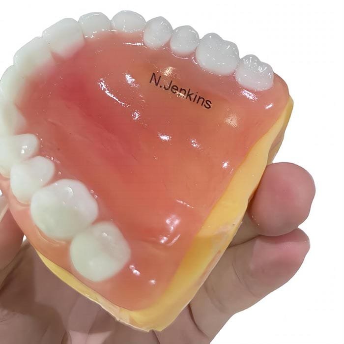 acrylic denture 3