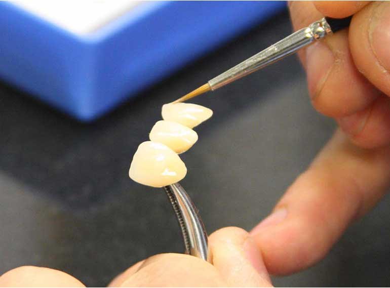 denture glazing2 denture glazing2