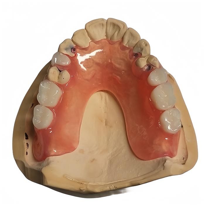 flexible denture 1 flexible denture 1