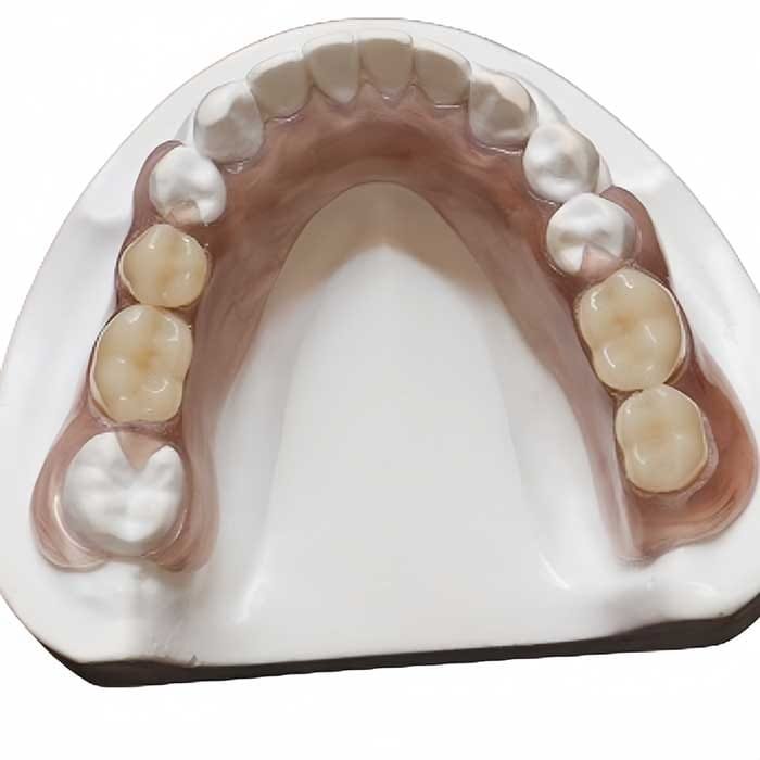 flexible denture 2