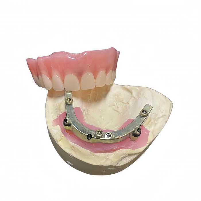 flexible denture 4