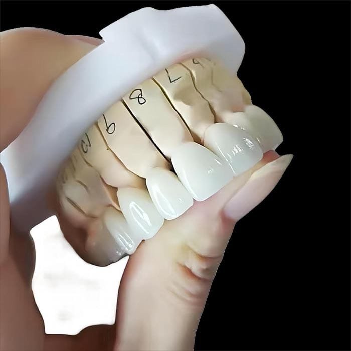 full-zirconia-4 full-zirconia-4