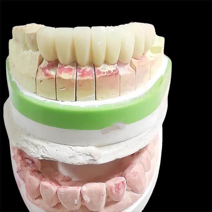 full-zirconia-5 full-zirconia-5