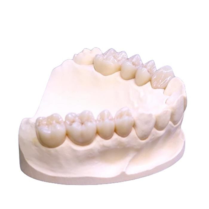 full zirconia 7 full zirconia 7