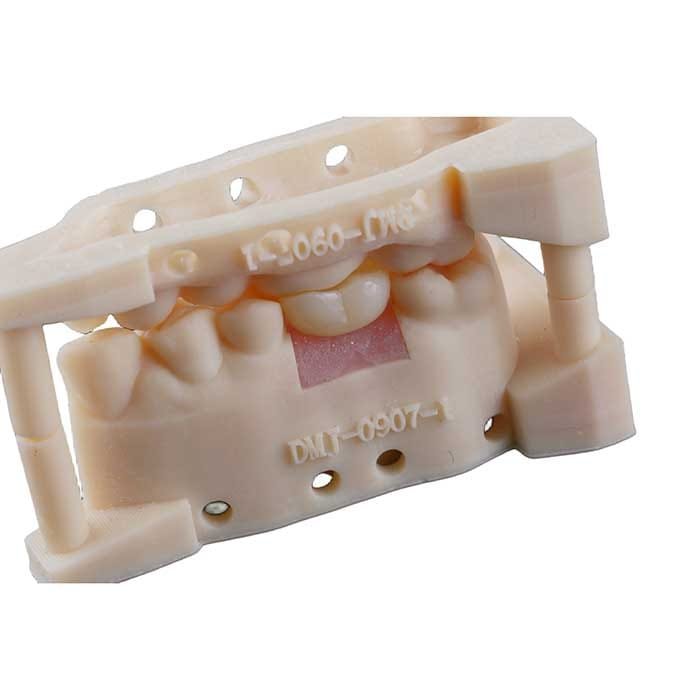 implant crown 7
