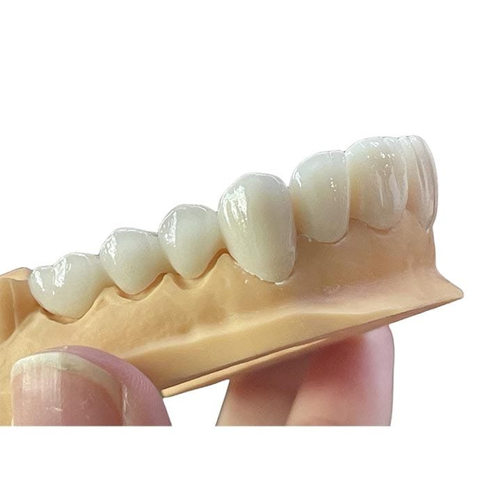 layered zirconia 2 layered zirconia 2