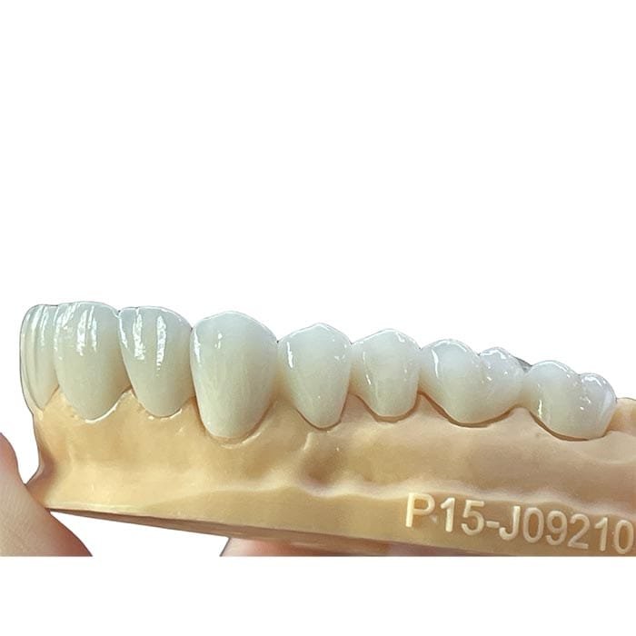 layered zirconia 3 layered zirconia 3