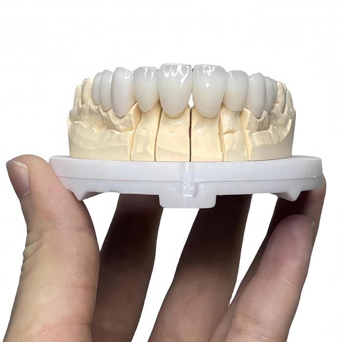layered zirconia 5 layered zirconia 5