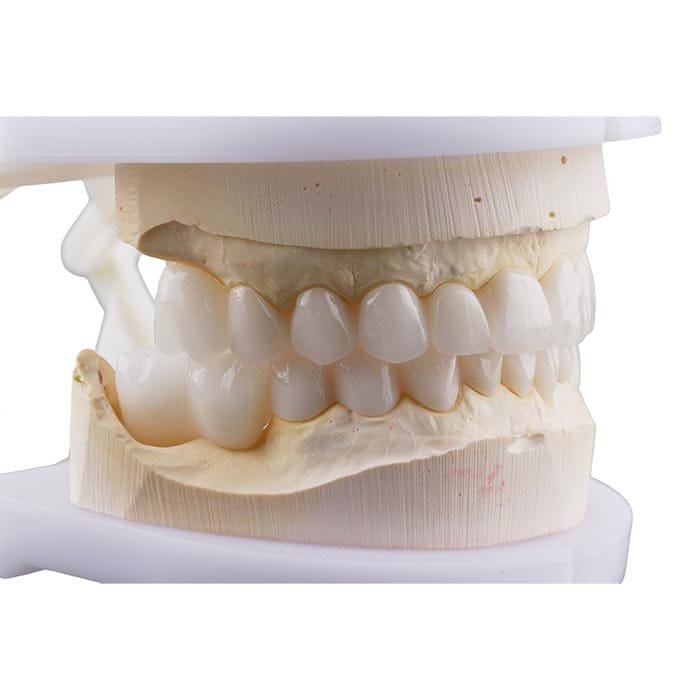 layered zirconia 7 layered zirconia 7