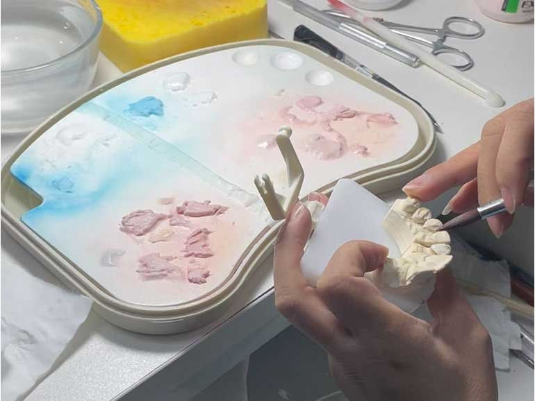 porcelain building up porcelain building up