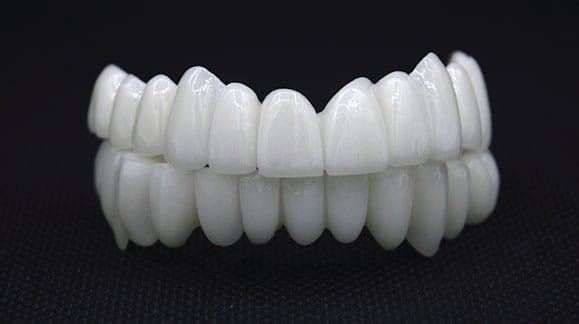 zirconia-bridge