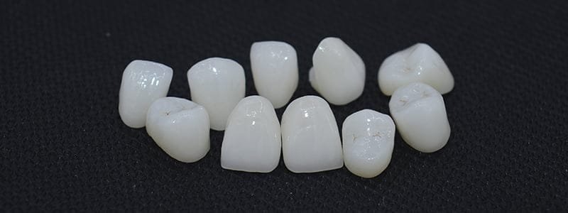 Full-Zirconia-Crowns