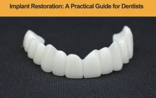 Implant-Restoration-A-Practical-Guide-for-Dentists