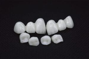 Zirconia-Veneers