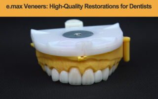 e.max-Veneers---High-Quality-Restorations