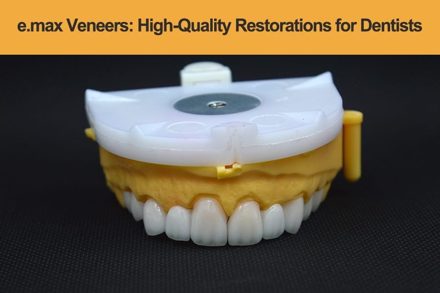 e.max-Veneers—High-Quality-Restorations e.max-Veneers---High-Quality-Restorations