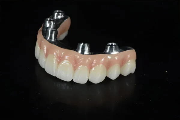 Acrylic-Implants