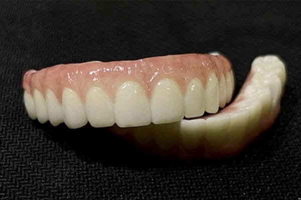 All-on-4-Dental-Implants