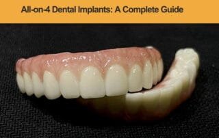 All-on-4-Dental-Implants-A-Complete-Guide