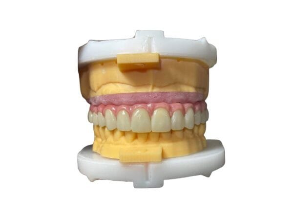 all-on-6-implants---SF-dental-lab