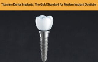 Titanium-Dental-Implants---The-Gold-Standard-for-Modern-Implant-Dentistry