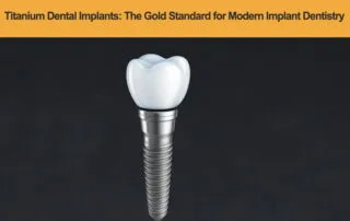 Titanium-Dental-Implants---The-Gold-Standard-for-Modern-Implant-Dentistry