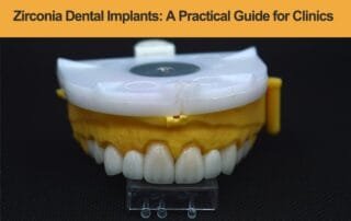 Zirconia-Dental-Implants--A-Practical-Guide-for-Modern-Clinics