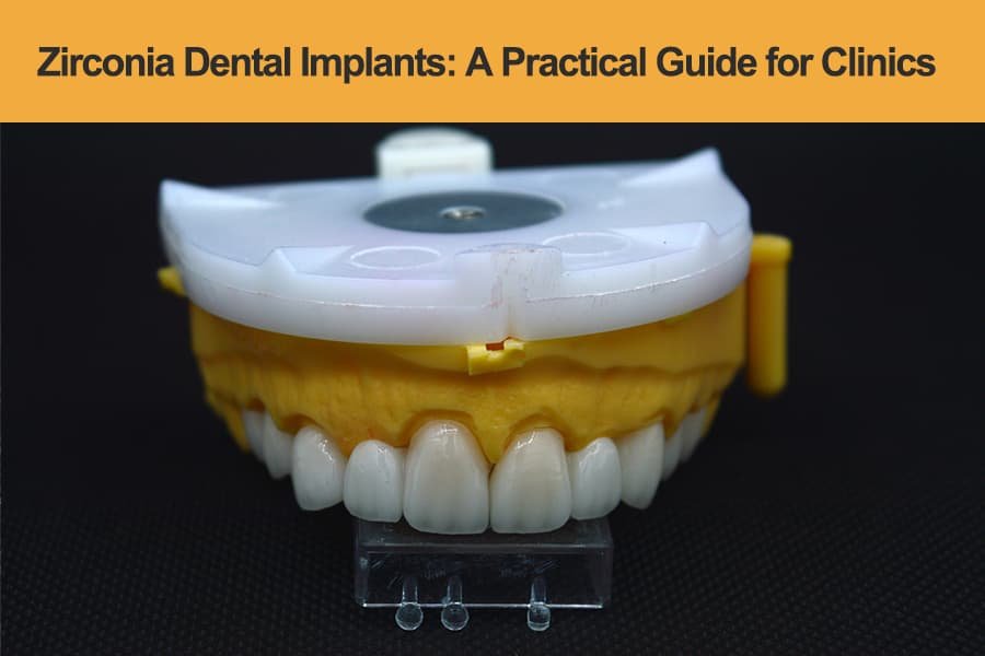 Zirconia-Dental-Implants--A-Practical-Guide-for-Modern-Clinics