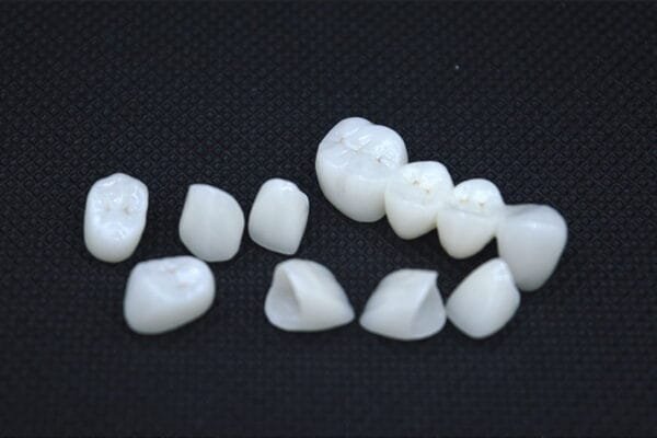 Zirconia-Veneers-01