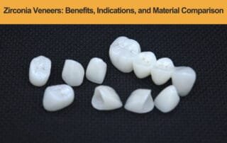 Zirconia-Veneers---Benefits,-Indications,-and-Material-Comparison