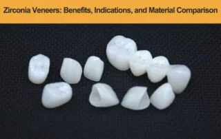 Zirconia-Veneers---Benefits,-Indications,-and-Material-Comparison