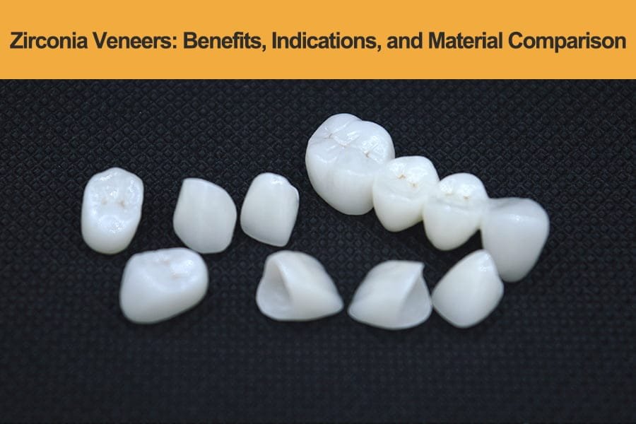 Zirconia-Veneers---Benefits,-Indications,-and-Material-Comparison