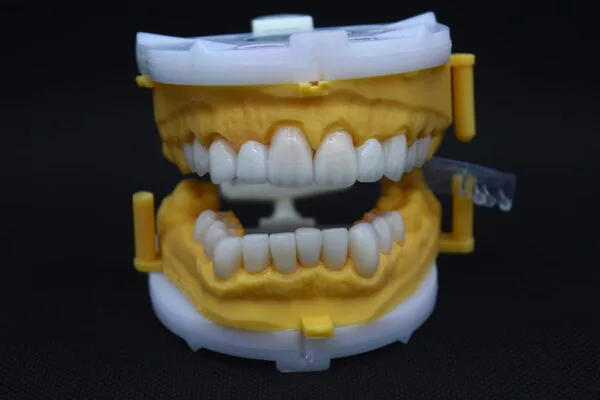 Brands-of-Dental-Implants-zircone-veneer
