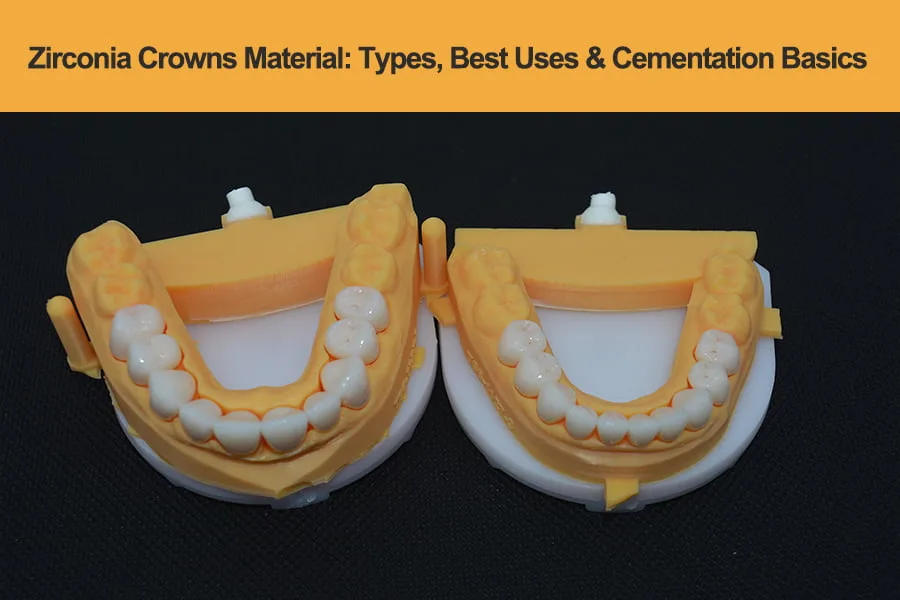 Zirconia-Dental-Implants--A-Practical-Guide-for-Modern-Clinics