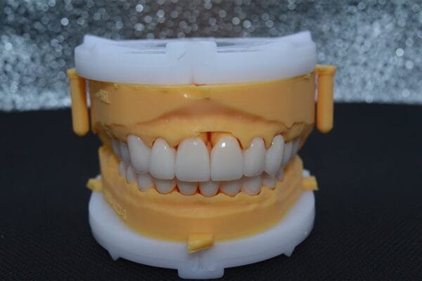 zirconia-crowns-materials