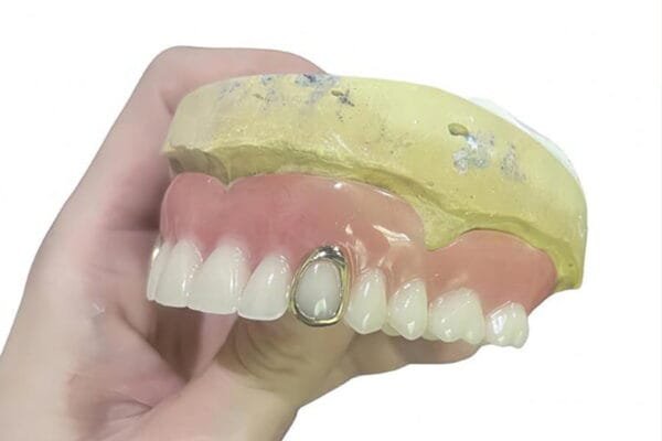 Metal-Dental-Partials
