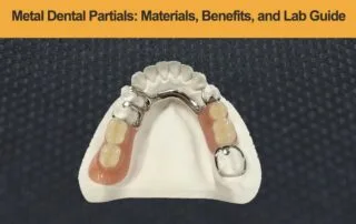 Metal-Dental-Partials---Materials,-Benefits,-and-Lab-Guide
