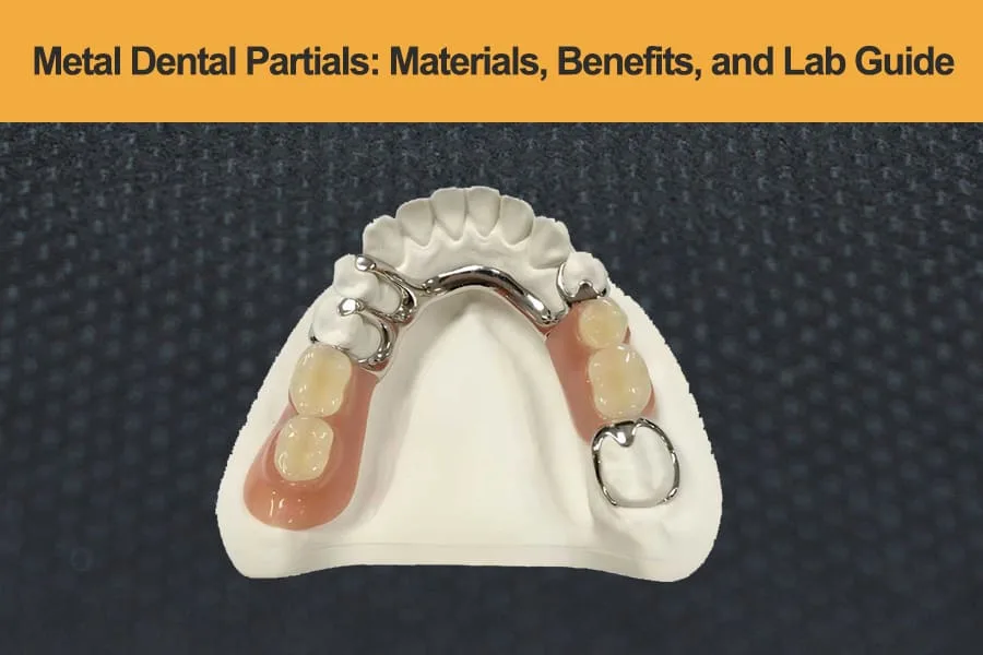 Metal-Dental-Partials---Materials,-Benefits,-and-Lab-Guide
